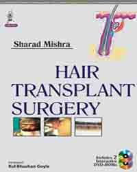 HAIR TRANSPLANT SURGERY - Retail Maharaj