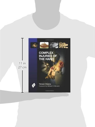 Complex Injuries of The Hand - Retail Maharaj