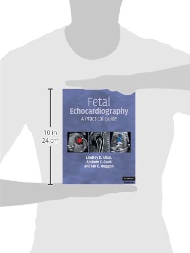 Fetal Echocardiography: A Practical Guide - Retail Maharaj