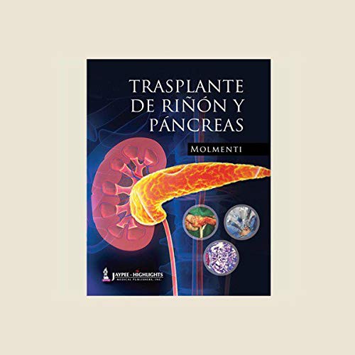 TRASPLANTE DE RINONY PANCREAS - Retail Maharaj