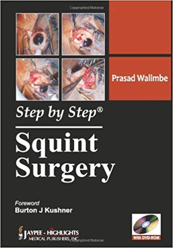 STEP BY STEP SQUINT SURGERY - Retail Maharaj