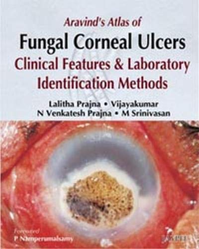 ARAVIND'S ATLAS OF FUNGAL CORNEAL ULCERS CLINICAL FEATURES & LAB.IDENTIFICATION METHODS - Retail Maharaj