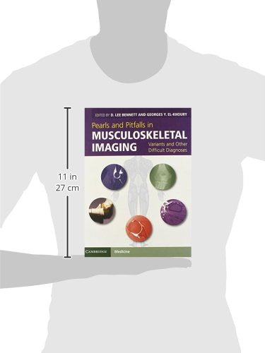 Pearls and Pitfalls in Musculoskeletal Imaging: Variants and Other Difficult Diagnoses - Retail Maharaj