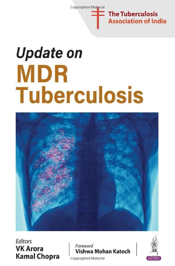 UPDATE ON MDR TUBERCULOSIS - Retail Maharaj