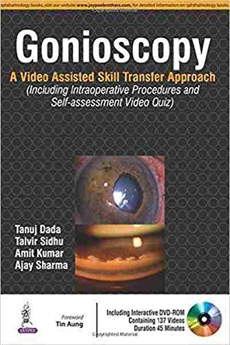 GONIOSCOPY:A VIDEO ASSISTED SKILL TRANSFER APPROACH WITH DVD-ROM - Retail Maharaj