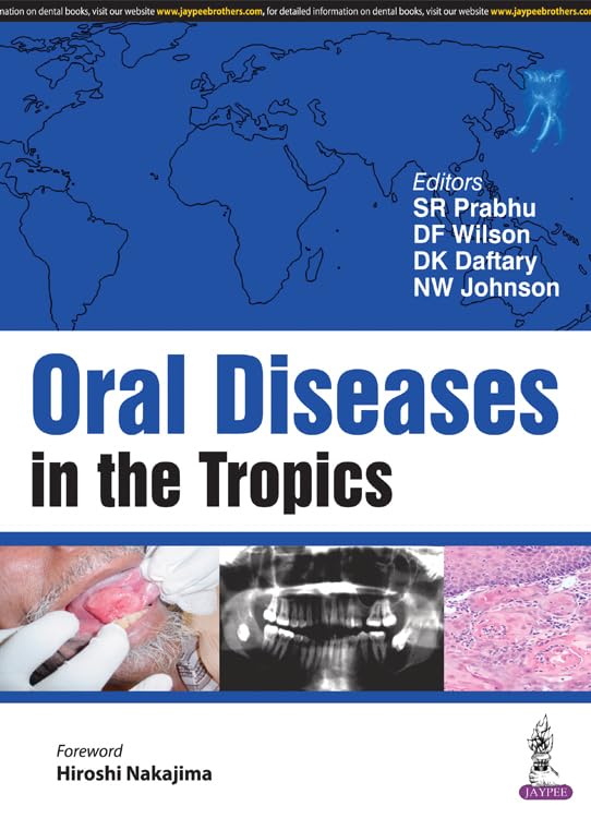 ORAL DISEASES IN THE TROPICS - Retail Maharaj
