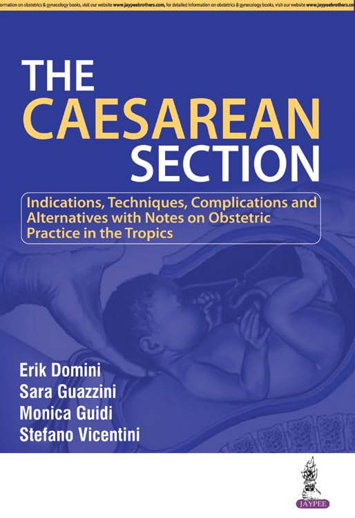 The Caesarean Section - Retail Maharaj