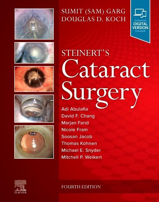 Steinert's Cataract Surgery - Retail Maharaj