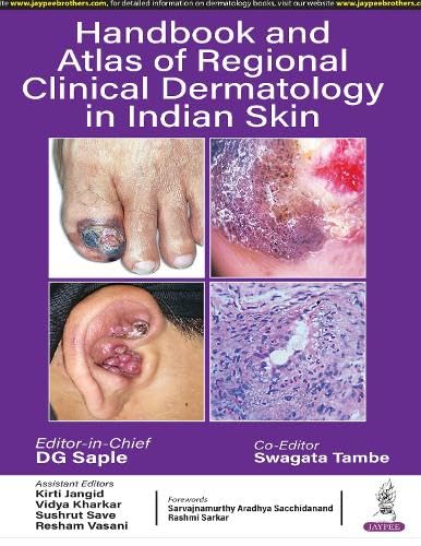 HANDBOOK AND ATLAS OF REGIONAL CLINICAL DERMATOLOGY IN INDIAN SKIN - Retail Maharaj