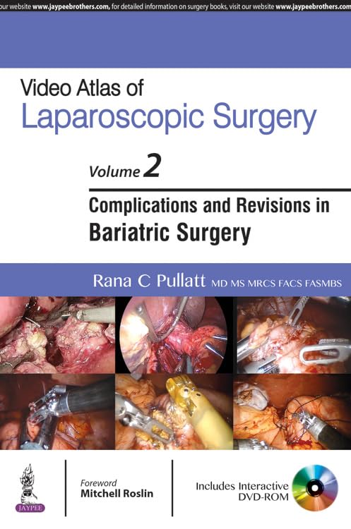 VIDEO ATLAS OF LAPAROSCOPIC SURGERY VOL.2 ,COMPLICATIONS AND REVISIONS IN BARIATRIC SURGERY WITH DVD - Retail Maharaj
