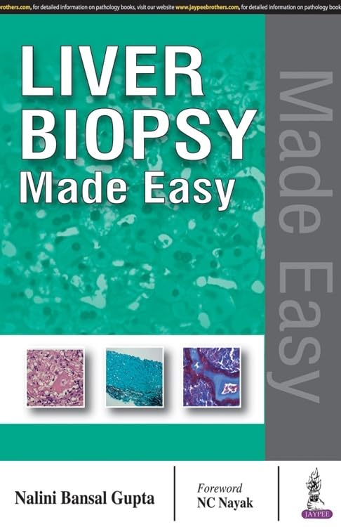 Liver Biopsy Made Easy - Retail Maharaj