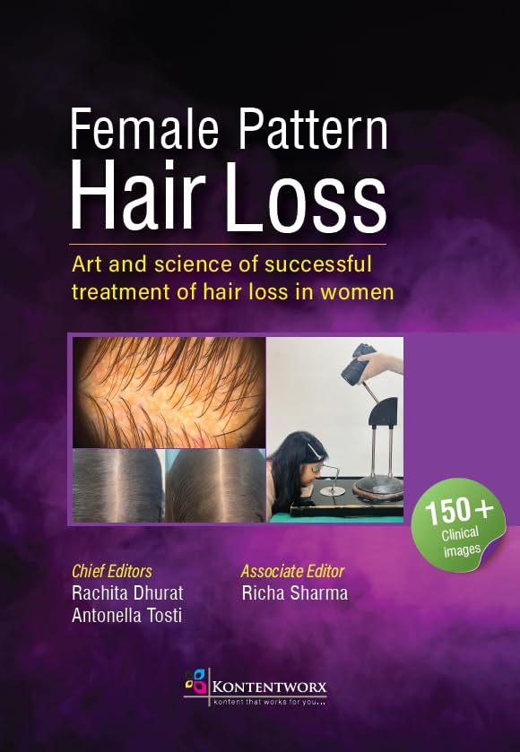 Female Pattern Hair Loss. Art and Science of Successful Treatment of Hair Loss in Women - Retail Maharaj