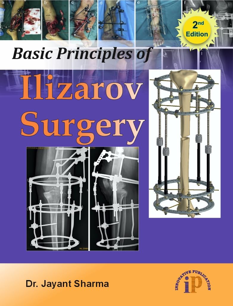 Basic Principles of Ilizarov Surgery (2e) - Second Edition - Retail Maharaj