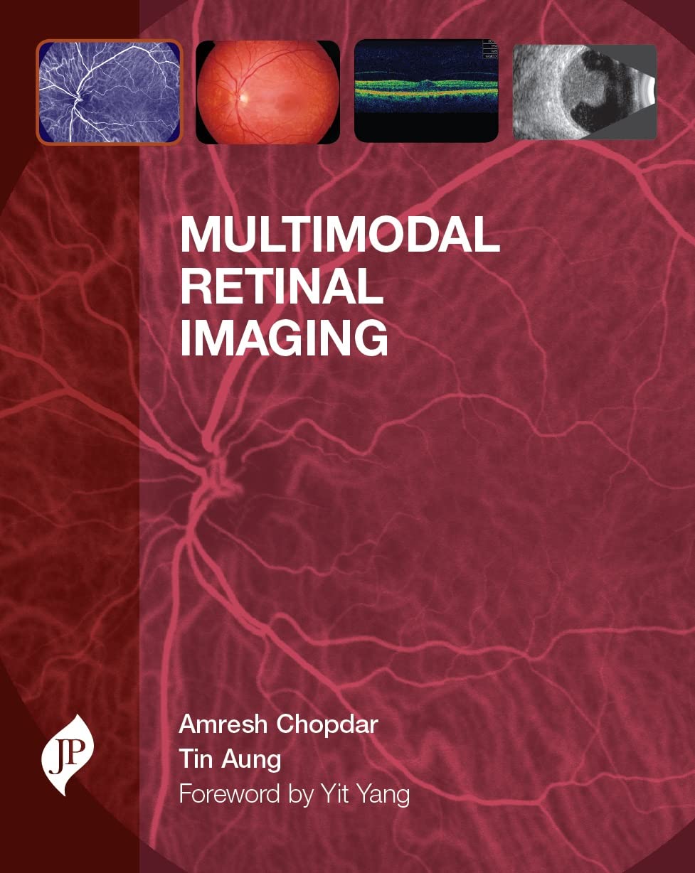 Multimodal Retinal Imaging - Retail Maharaj