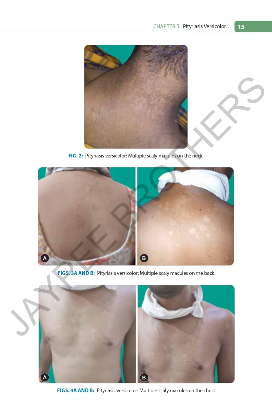 FUNGAL INFECTIONS WITH COLOR ALTAS - Retail Maharaj