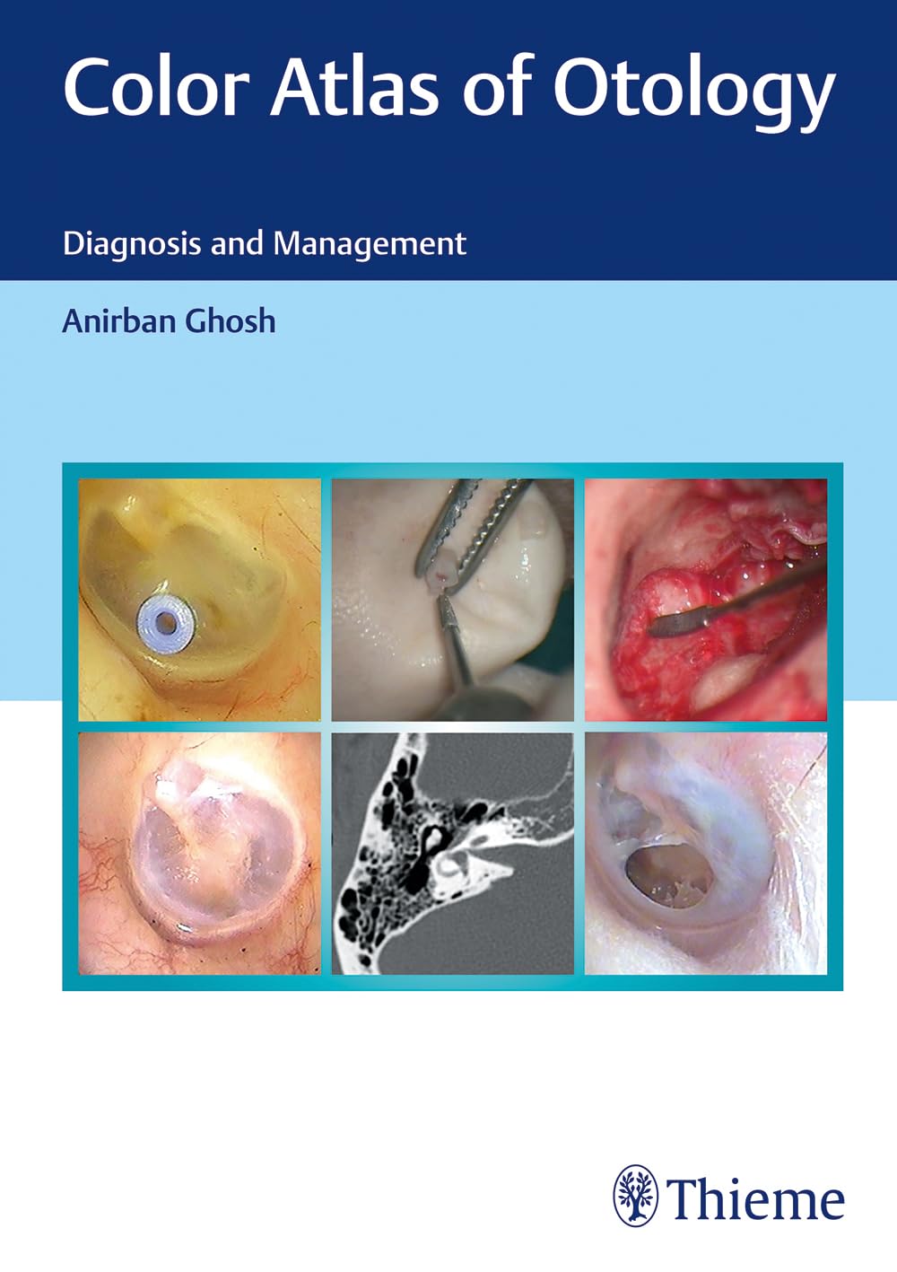 Color Atlas of Otology - Retail Maharaj