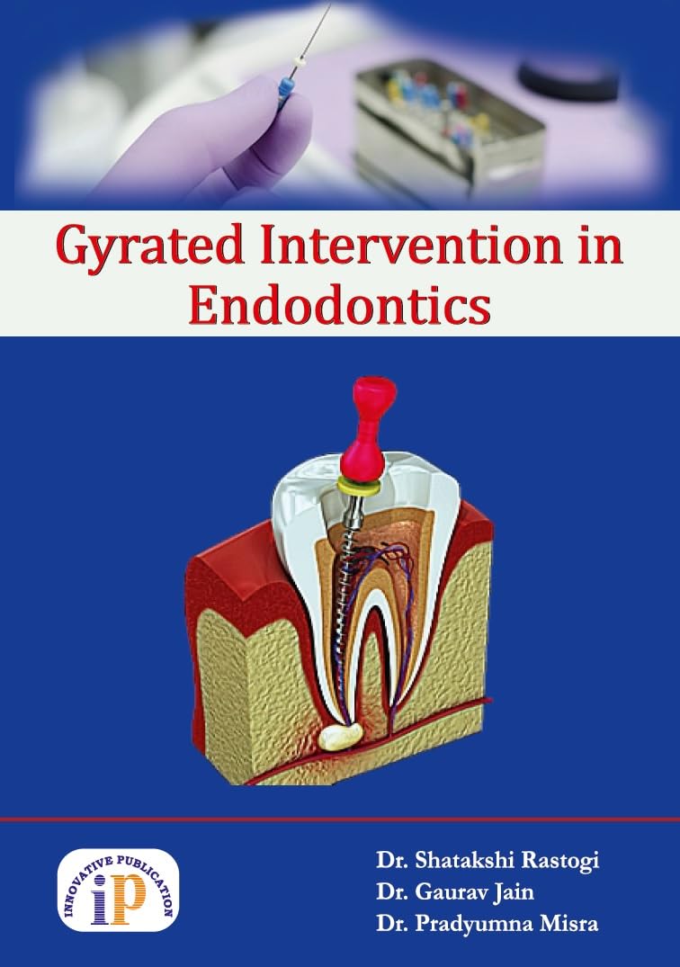 Gyrated Intervention in Endodontics - Retail Maharaj