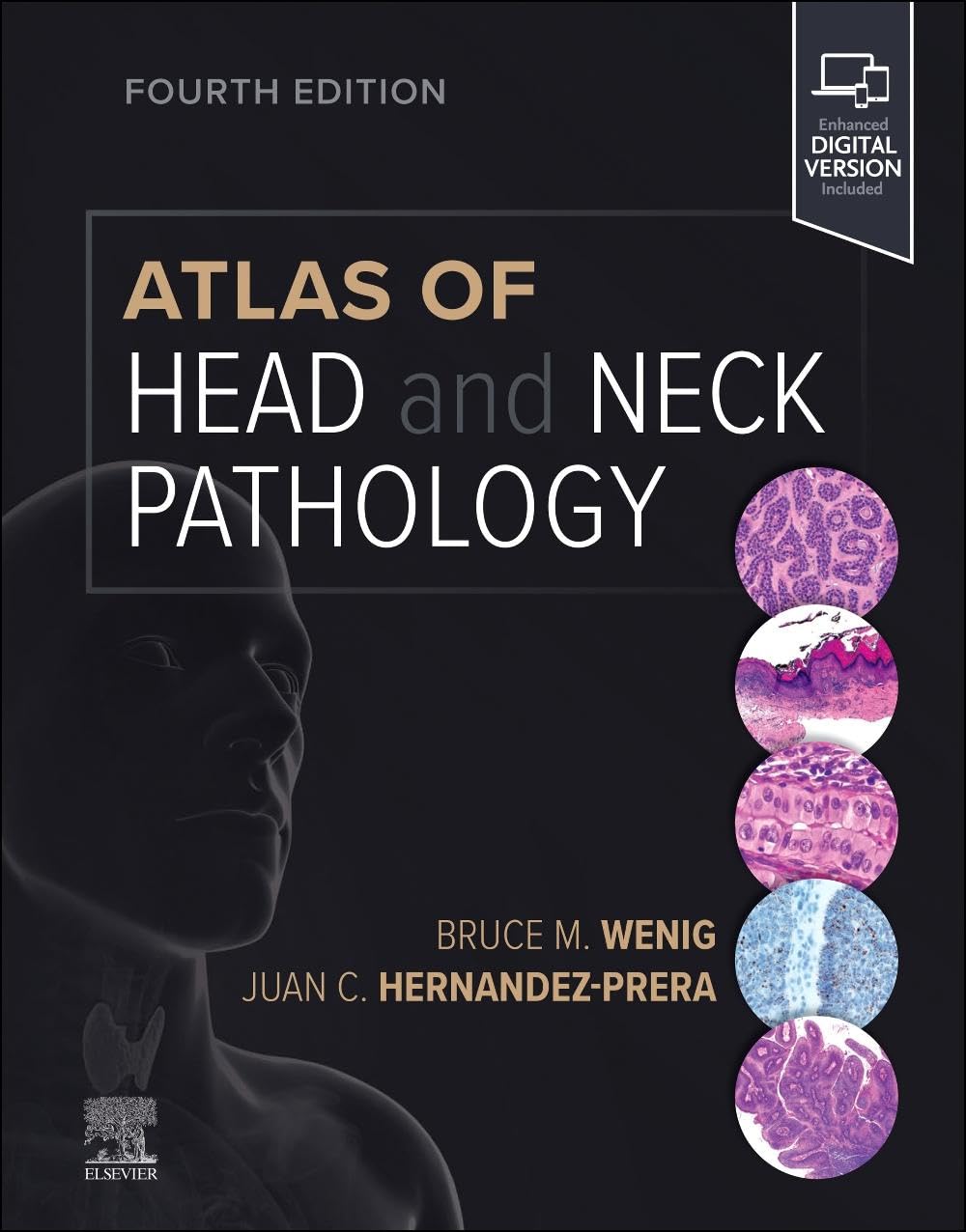 ATLAS OF HEAD AND NECK PATHOLOGY WITH ACCESS CODE 4ED (HB 2024) (Atlas of Surgical Pathology) - Retail Maharaj