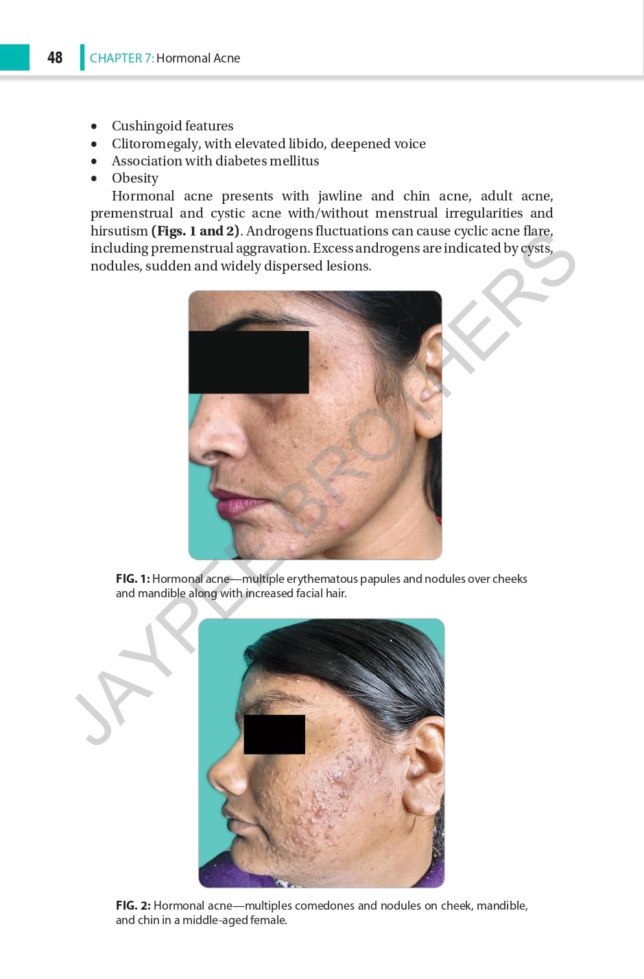HANDBOOK ON ACNE - Retail Maharaj