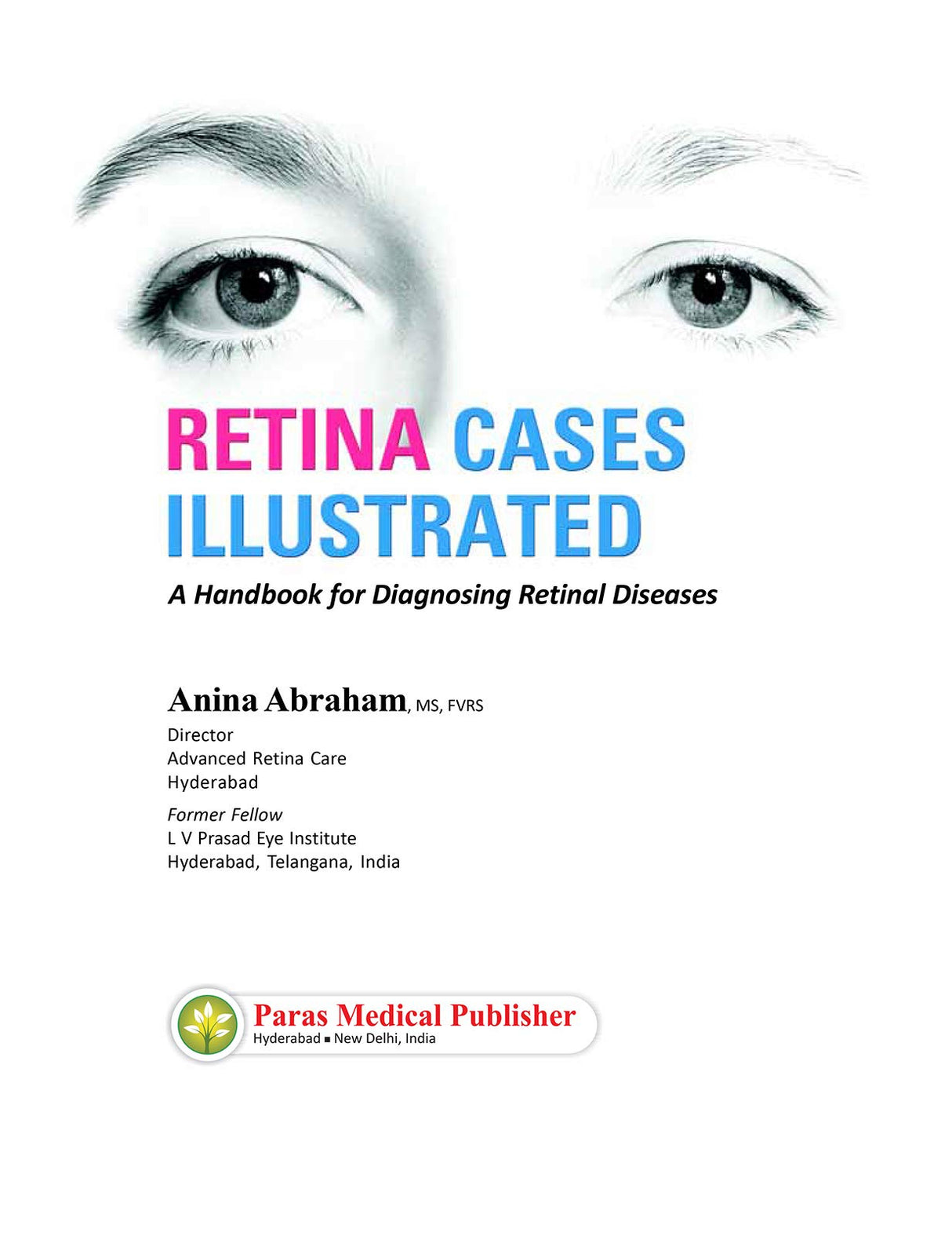 Retina Cases Illustrated - Retail Maharaj