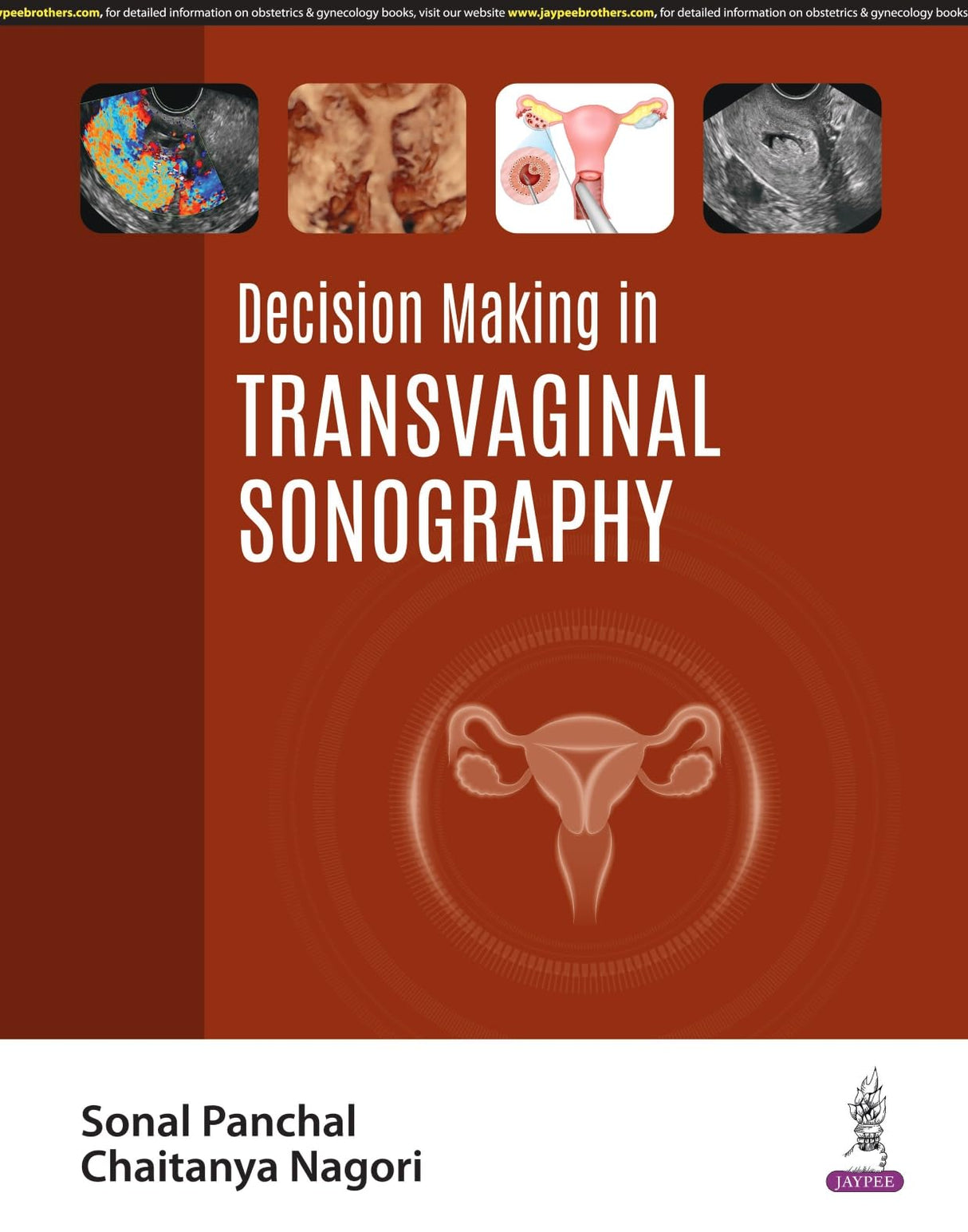 DECISION MAKING IN TRANSVAGINAL SONOGRAPHY - Retail Maharaj