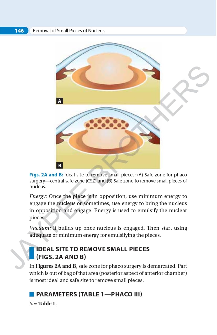 SIMPLIFIED PHACOEMULSIFICATION - Retail Maharaj