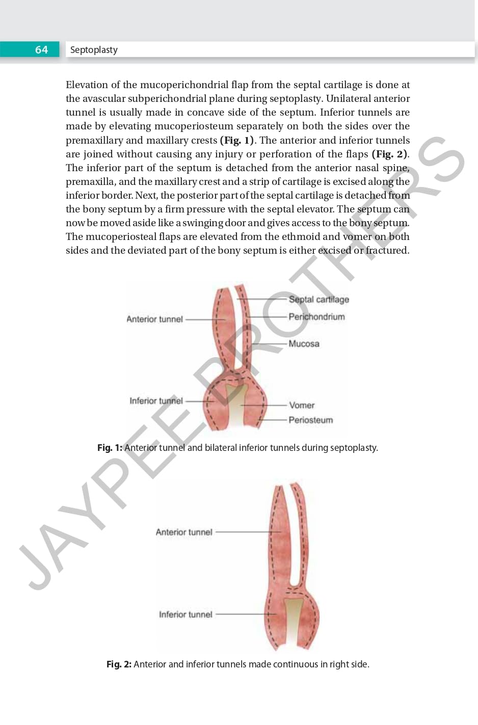 RHINOPLASTY AN EXPERT MANUAL - Retail Maharaj