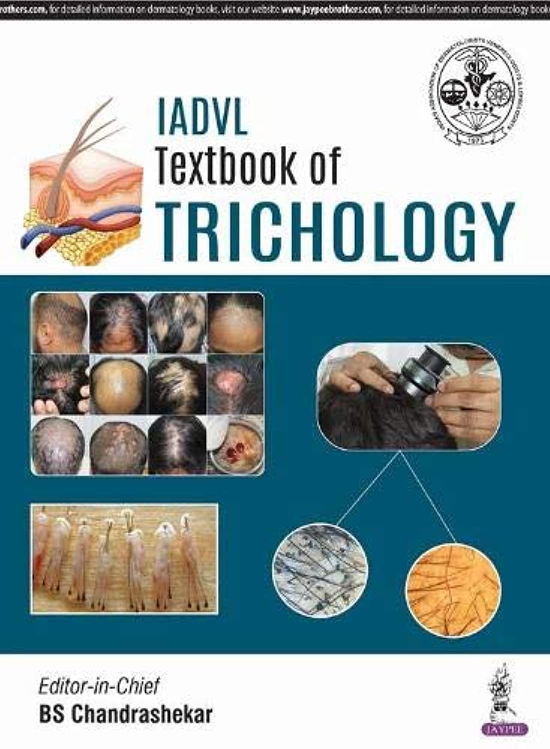 IADVL Textbook of Trichology - Retail Maharaj