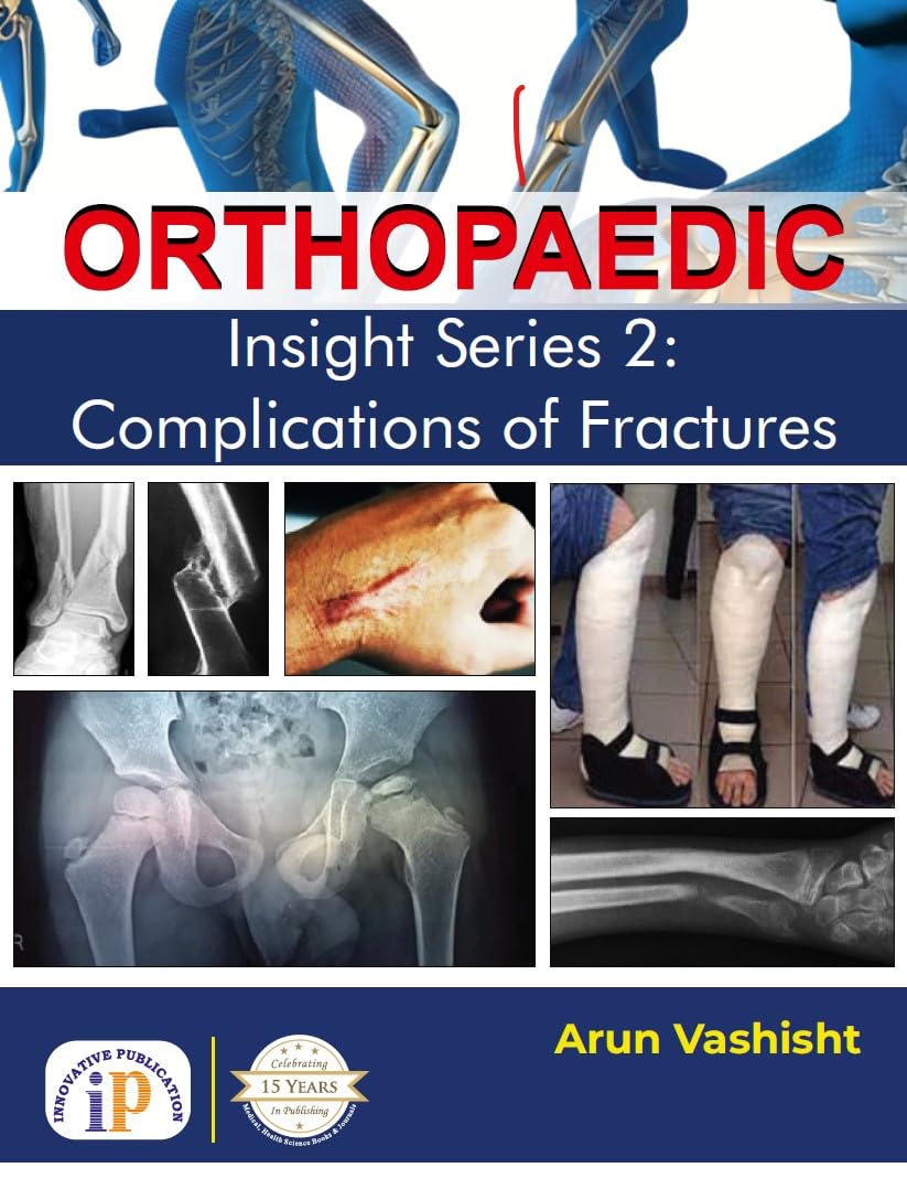Orthopaedic Insight Series 2: Complications of Fractures - Retail Maharaj