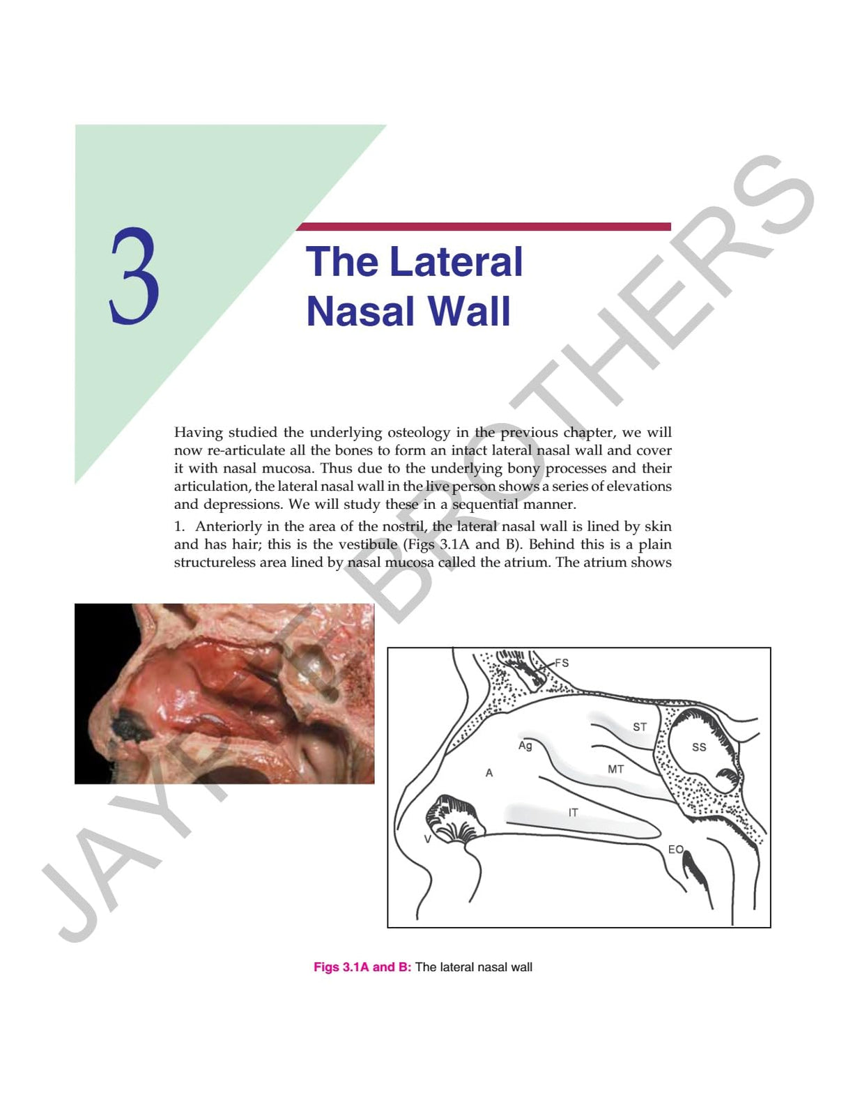 ANATOMICAL PRINCIPLES OF ENDOSCOPIC SINUS SURGERY: A STEP BY STEP APPROACH WITH INTERACTIVE CD-ROM - Retail Maharaj