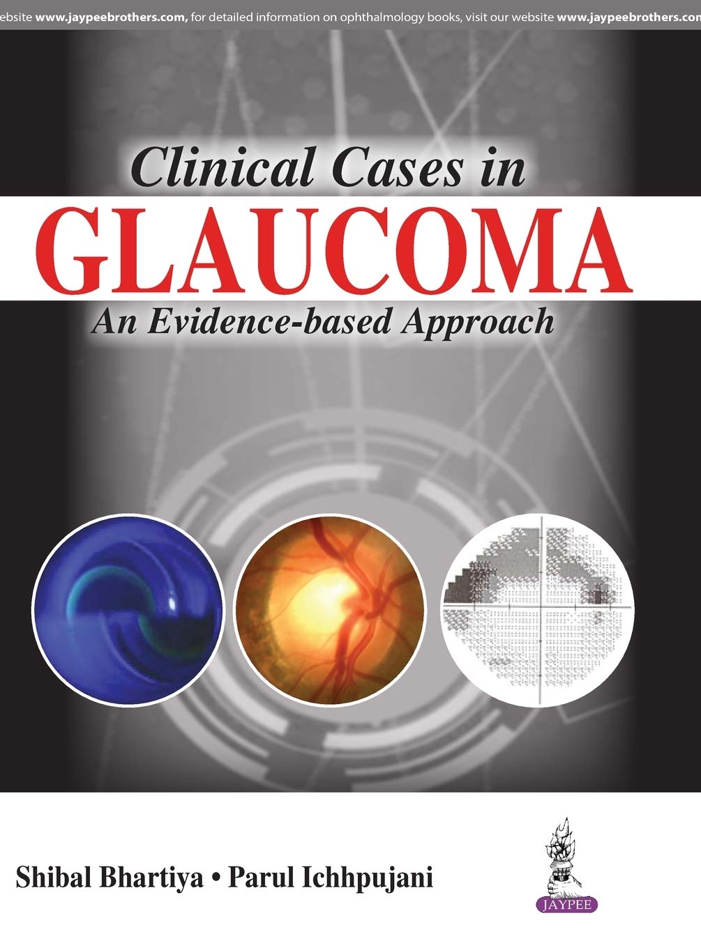 CLINICAL CASES IN GLAUCOMA AN EVIDENCE-BASED APPROACH - Retail Maharaj