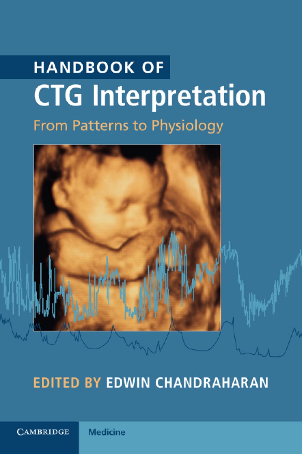 Handbook of CTG Interpretation: From Patterns to Physiology - Retail Maharaj