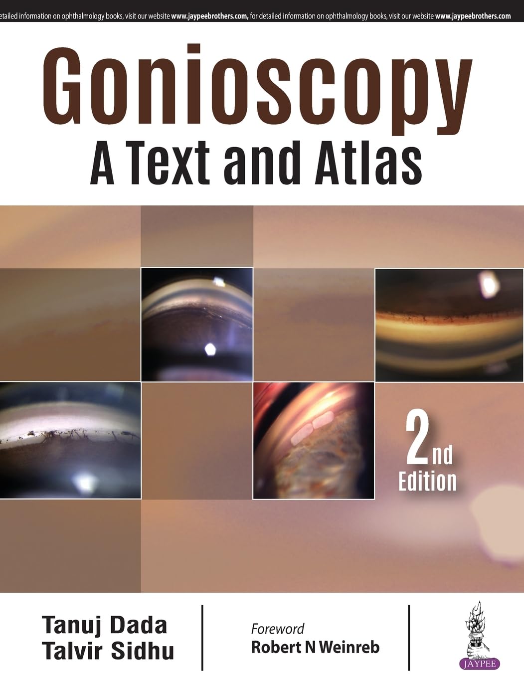 Gonioscopy: A Text and Atlas - Retail Maharaj