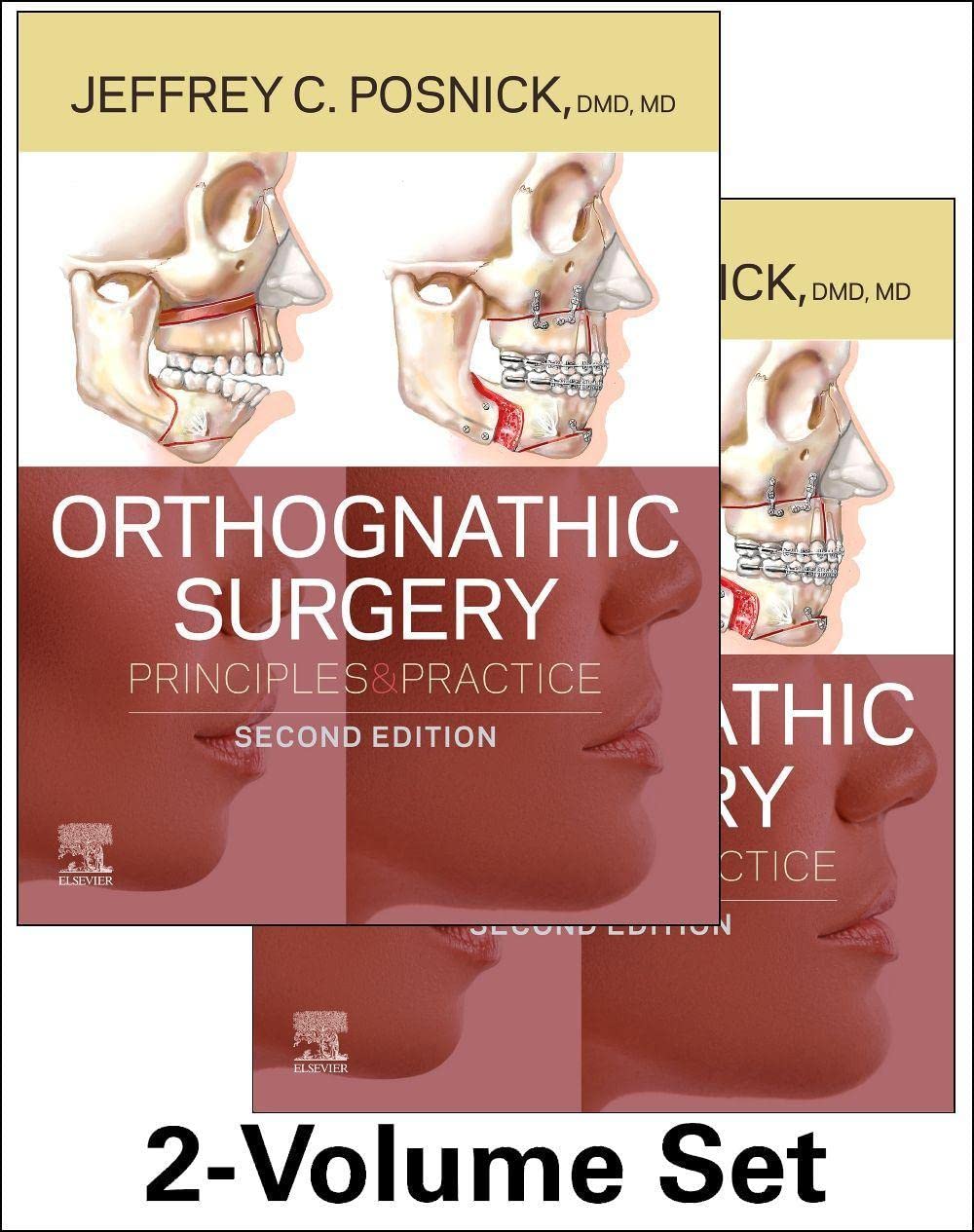 Orthognathic Surgery - 2 Volume Set - Retail Maharaj