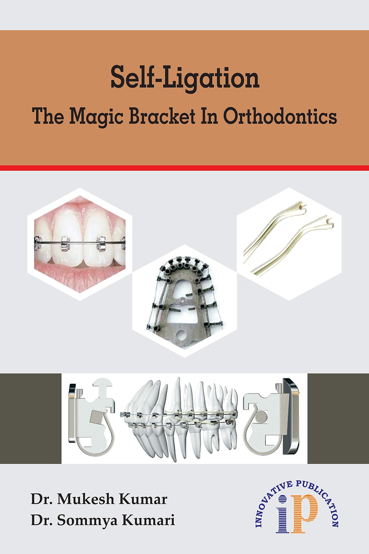 Self-Ligation - The Magic Bracket In Orthodontics - Retail Maharaj