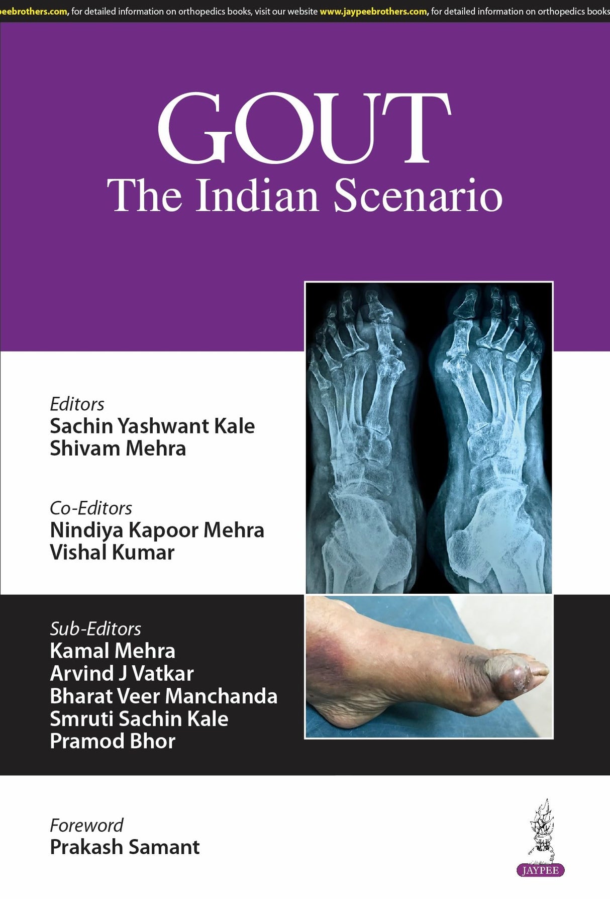 GOUT THE INDIAN SCENARIO - Retail Maharaj