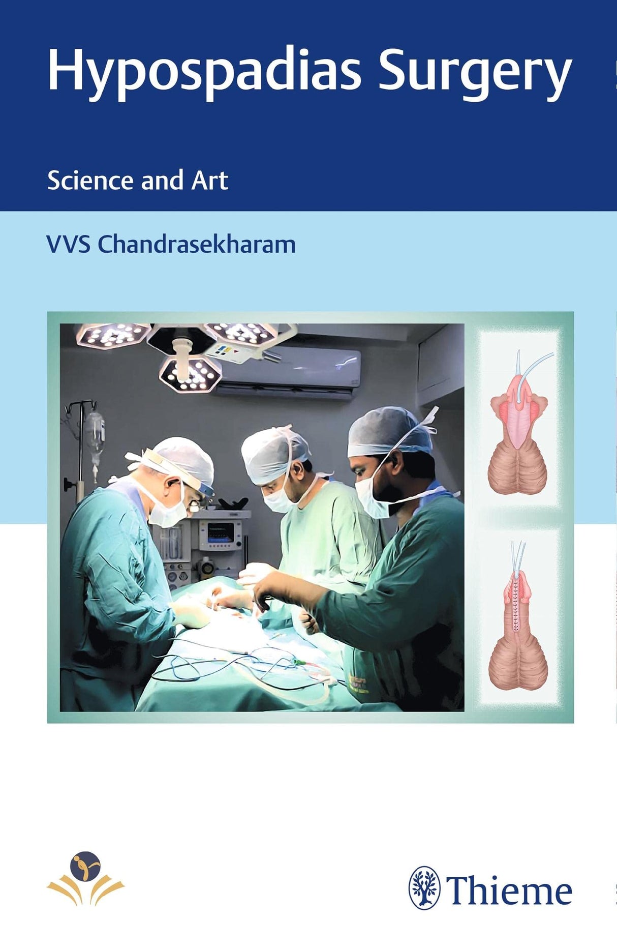 Hypospadias Surgery 1st Ed. - Retail Maharaj