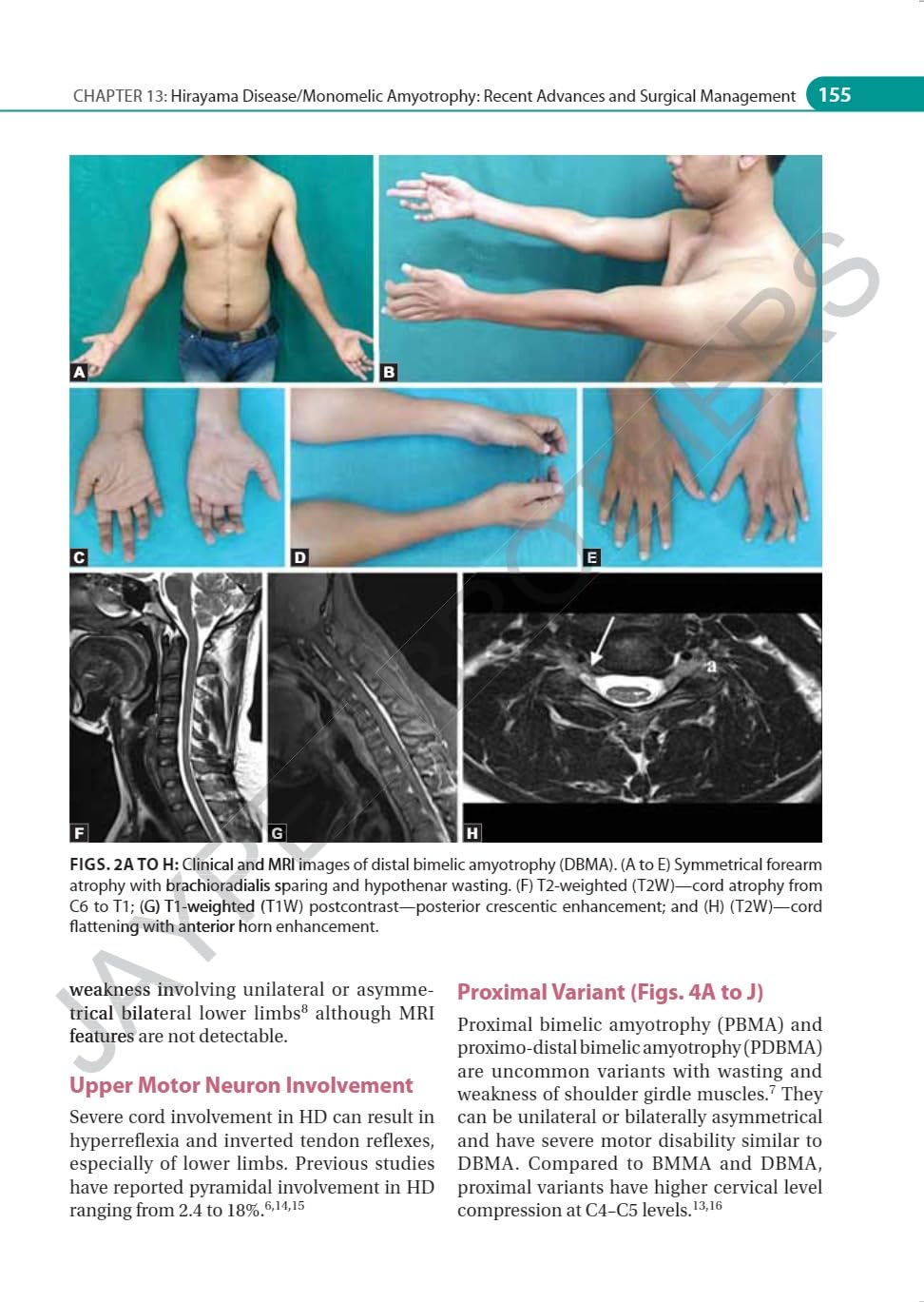 IAN ADVANCES IN NEUROMUSCULAR DISORDERS - Retail Maharaj