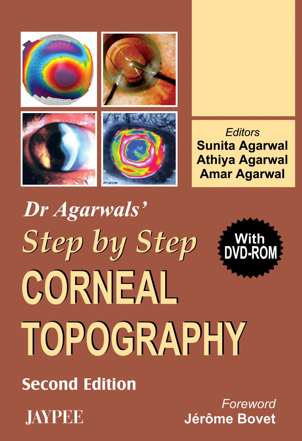 DR.AGARWALS' STEP BY STEP CORNEAL TOPOGRAPHY WITH DVD-ROM - Retail Maharaj