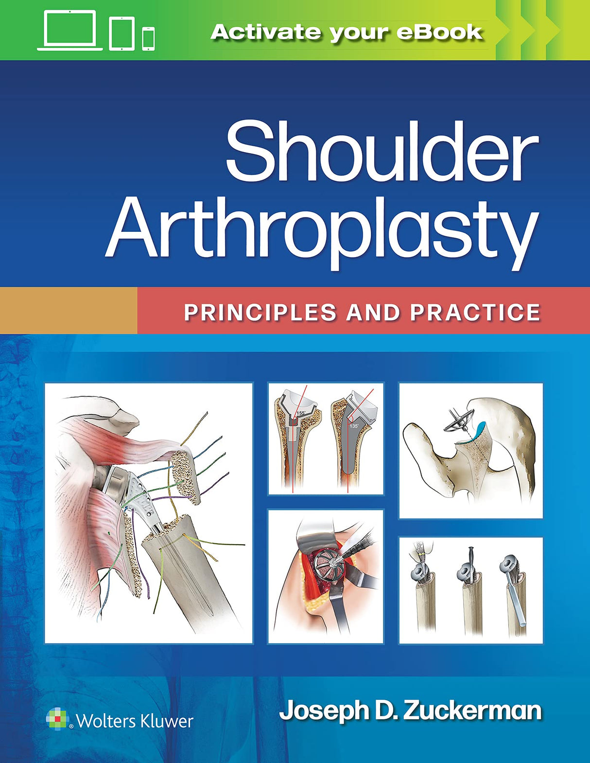 Shoulder Arthroplasty: Principles and Practice - Retail Maharaj