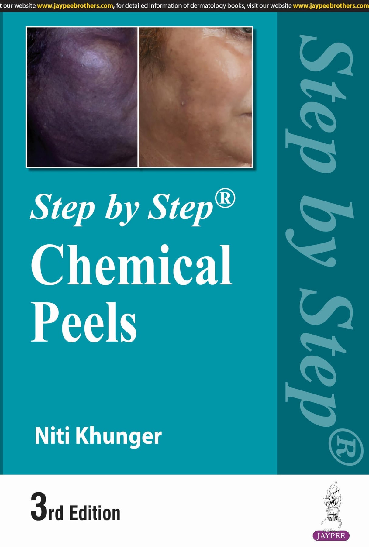 STEP BY STEP CHEMICAL PEELS - Retail Maharaj