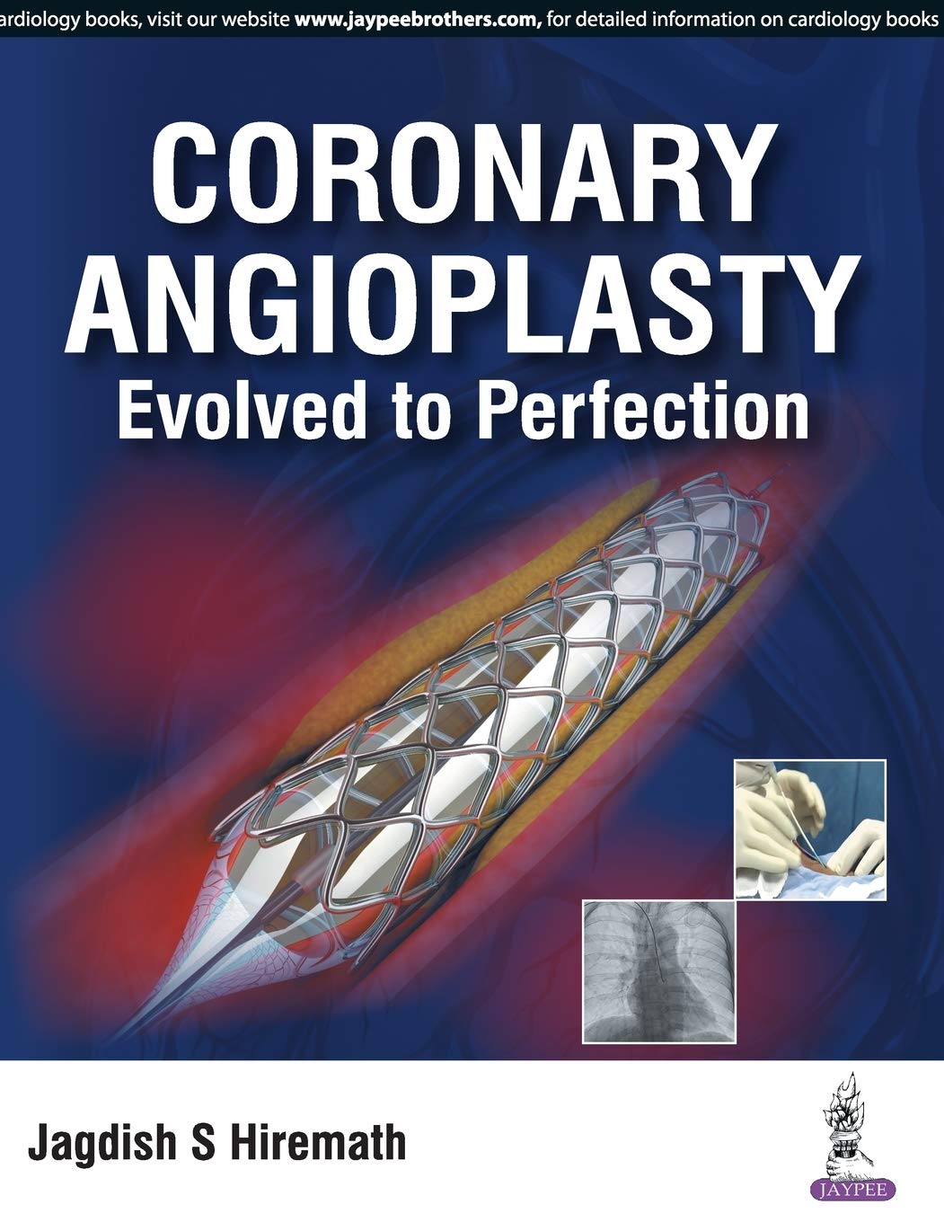 CORONARY ANGIOPLASTY EVOLVED TO PERFECTION - Retail Maharaj