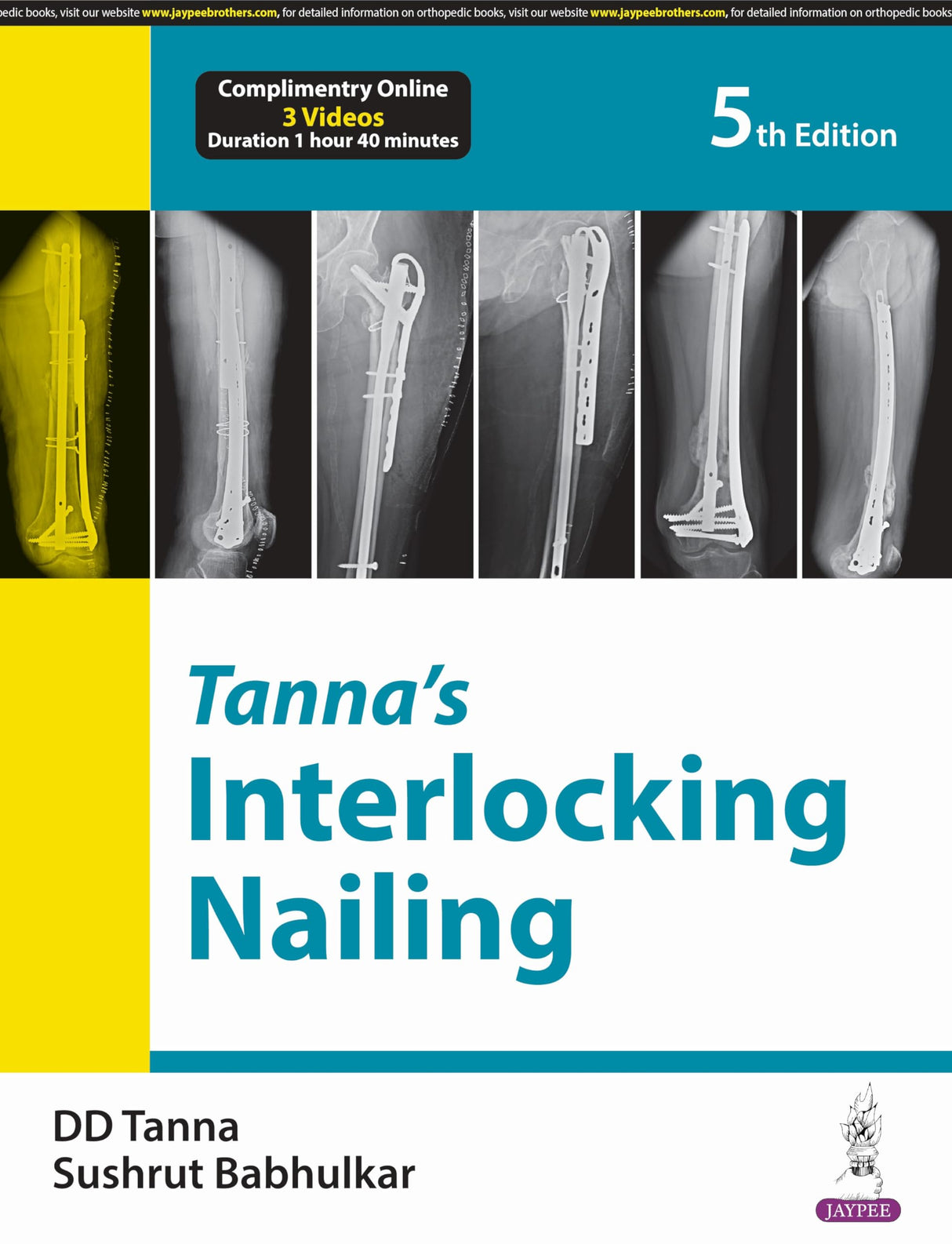 Tanna’s Interlocking Nailing - Retail Maharaj