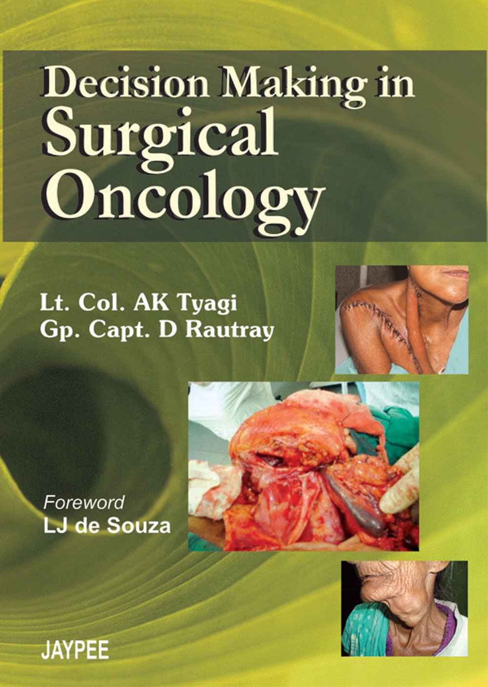 DECISION MAKING IN SURGICAL ONCOLOGY - Retail Maharaj