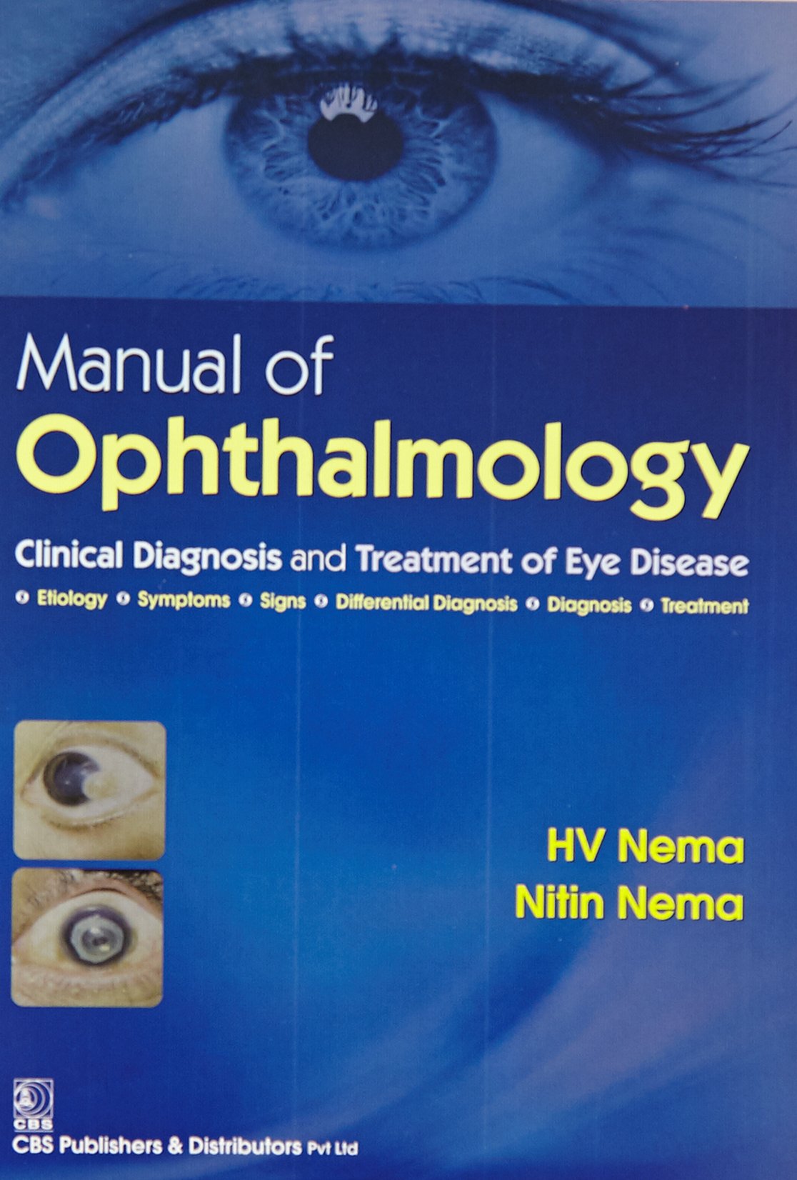 Manual Of Opthalmology Clinical Diagnosis And Treatment Of Eye Disease (Pb 2016) - Retail Maharaj