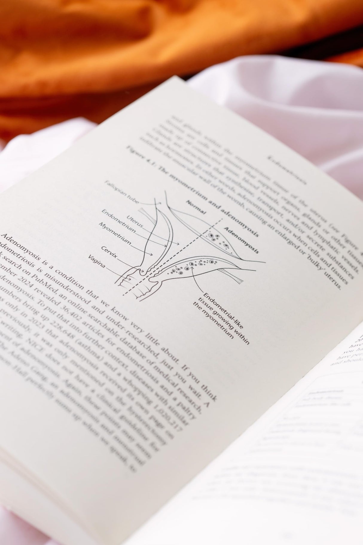 Endometriosis: Understand your symptoms, get the right treatment, reclaim your life - Retail Maharaj