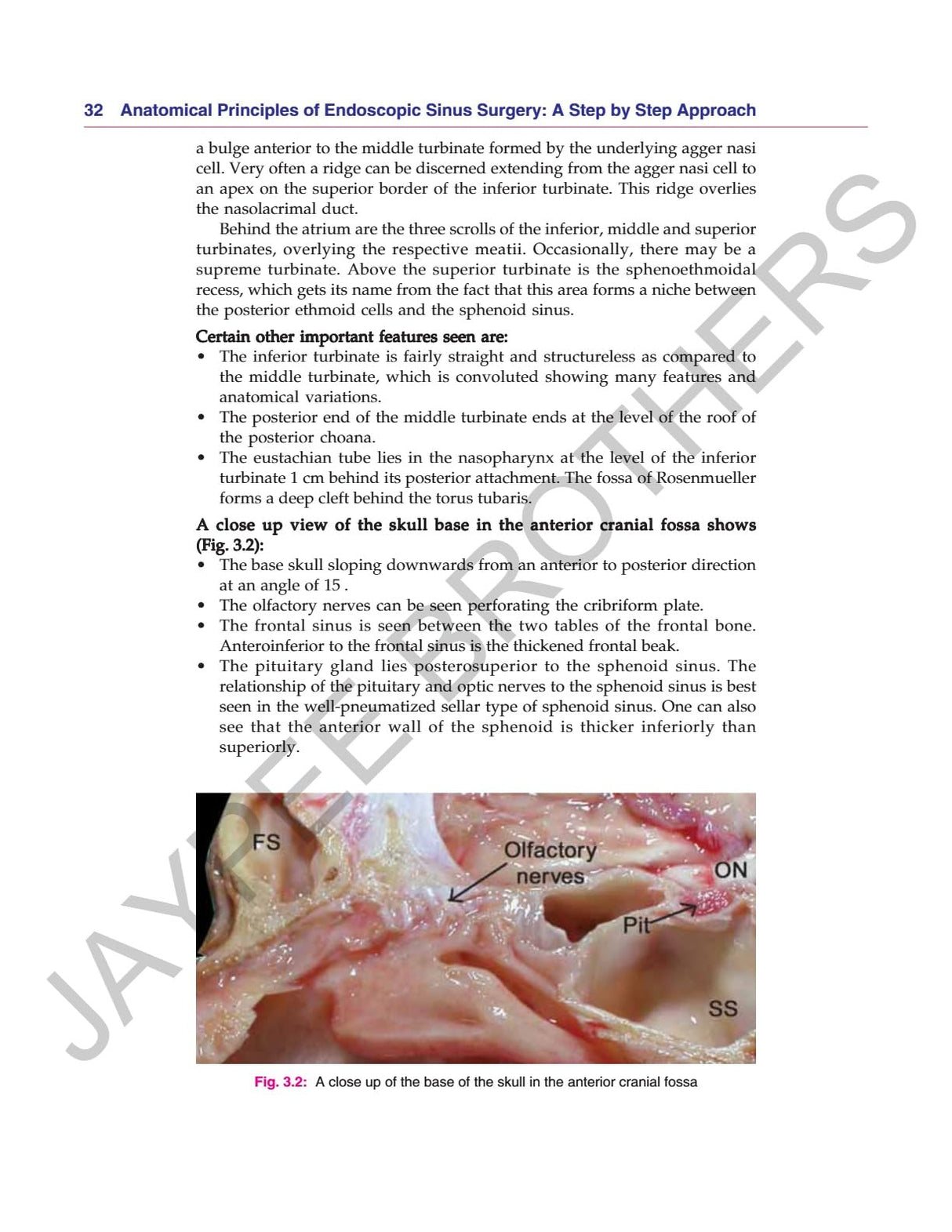 ANATOMICAL PRINCIPLES OF ENDOSCOPIC SINUS SURGERY: A STEP BY STEP APPROACH WITH INTERACTIVE CD-ROM - Retail Maharaj
