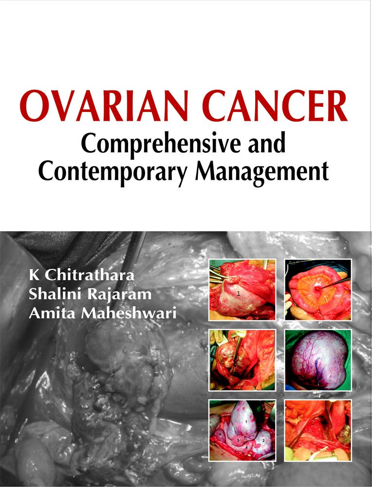 OVARIAN CANCER COMPREHENSIVE AND CONTEMPORARY MANAGEMENT - Retail Maharaj