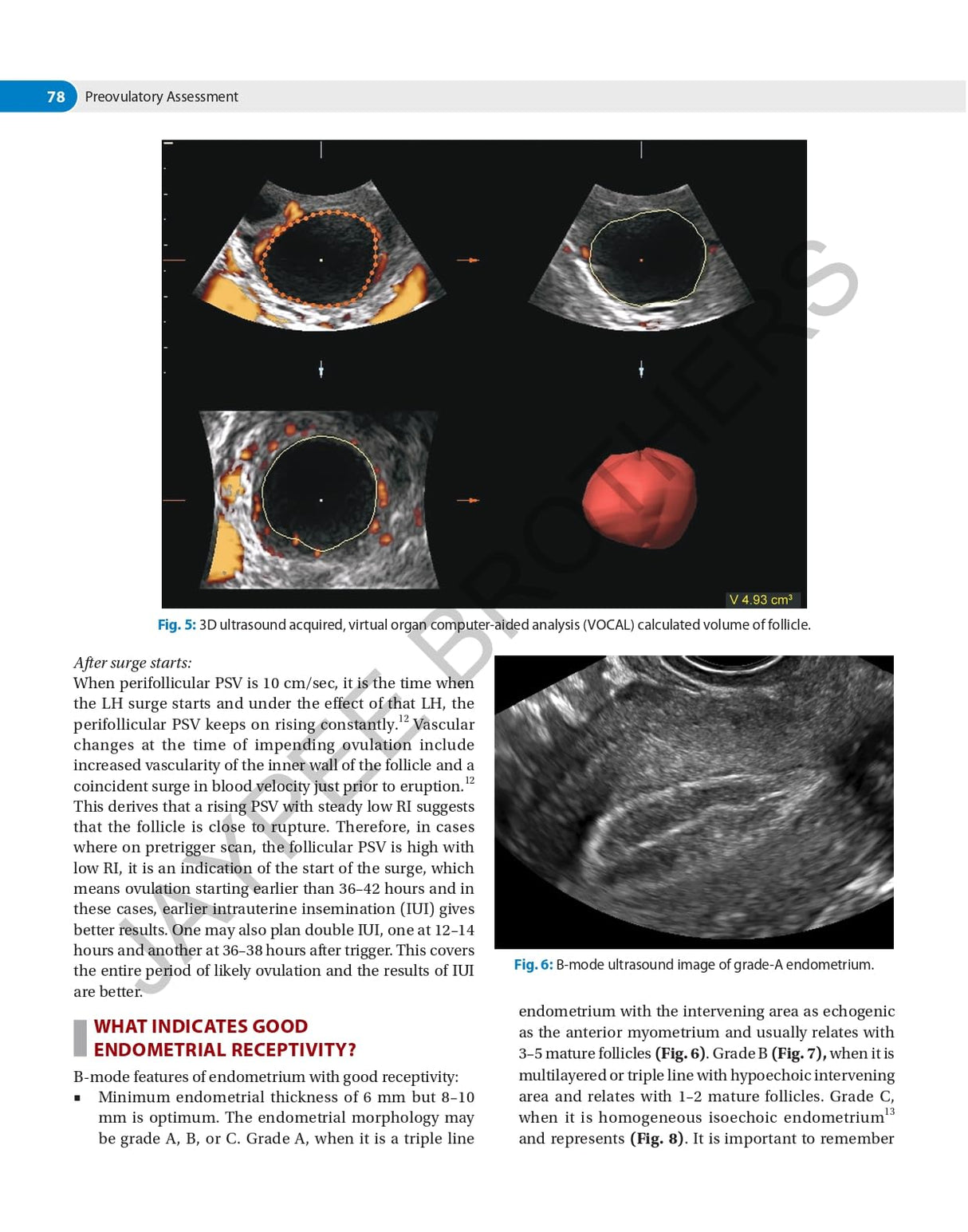 DECISION MAKING IN TRANSVAGINAL SONOGRAPHY - Retail Maharaj