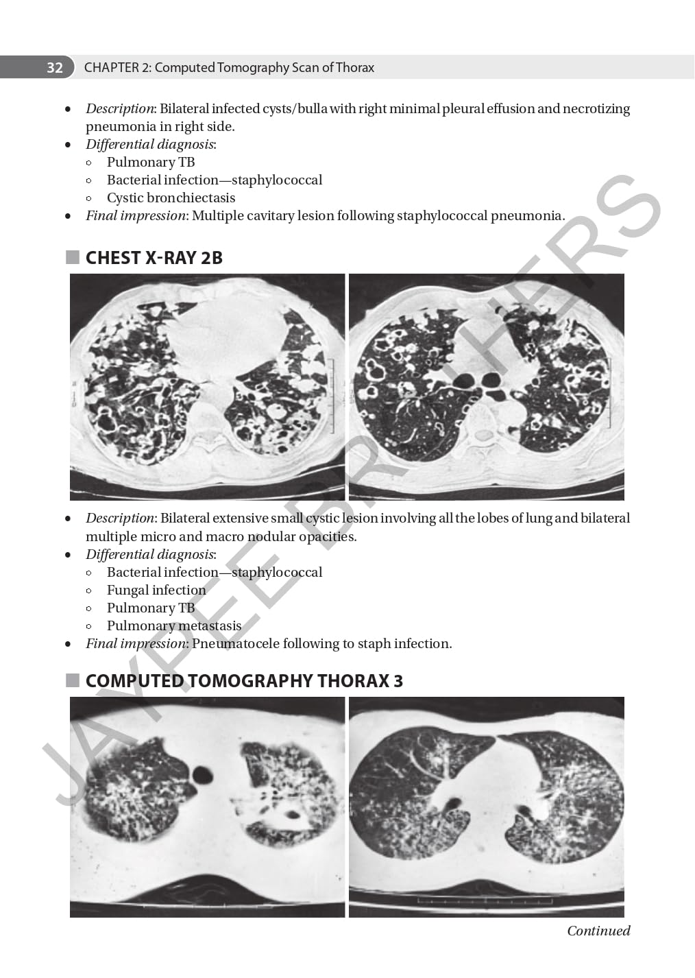 AN AID TO RESPIRATORY MEDICINE FOR POSTGRADUATE EXIT EXAM (MD, DNB AND DIPLOMA) - Retail Maharaj
